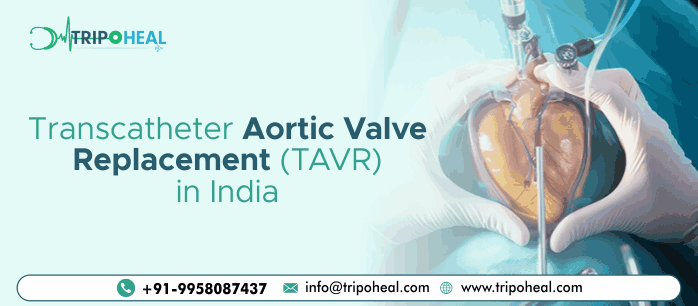 Transcatheter Aortic Valve Replacement (TAVR) in India