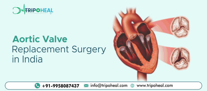 Aortic Valve Replacement In India