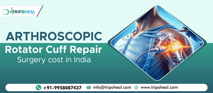 Arthroscopic Rotator Cuff Repair in India