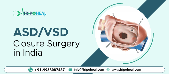 ASD VSD Closure Surgery in India