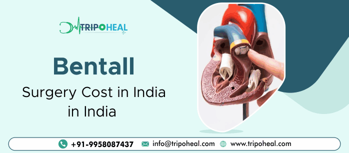 Bentall Surgery in India