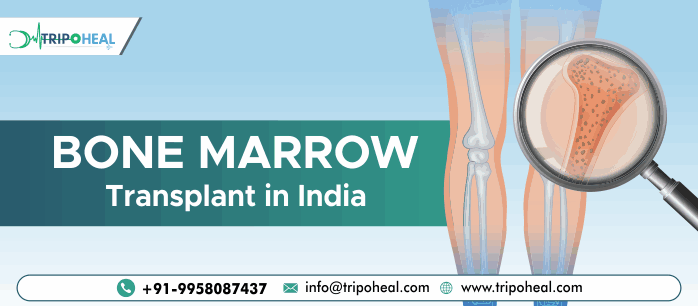  Bone Marrow Transplant in India