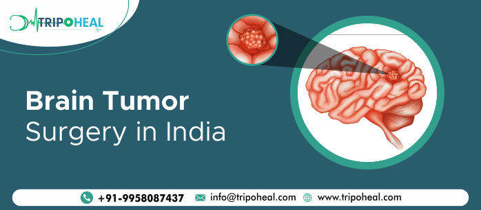 Brain Tumor Surgery in India