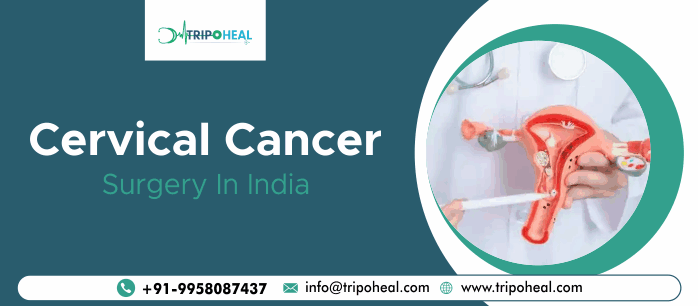 Cervical Cancer Treatment in India