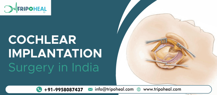 cochlear implant surgery in India