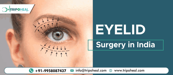 Eyelid Surgery in India