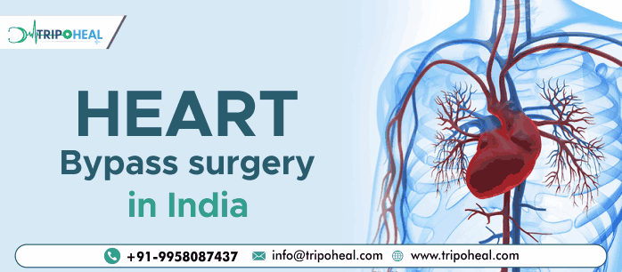 Coronary artery bypass graft (CABG) surgery