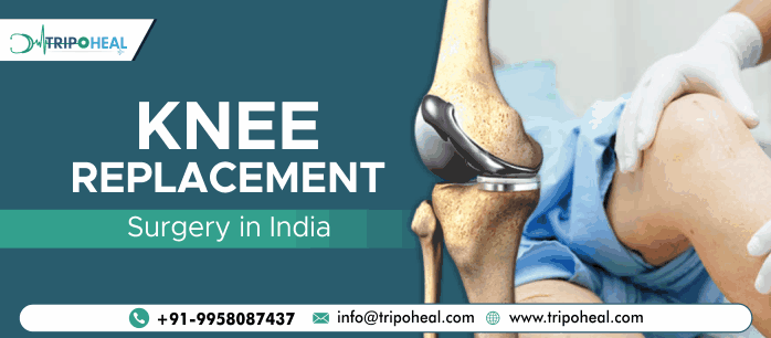 Knee Replacement Surgery in India