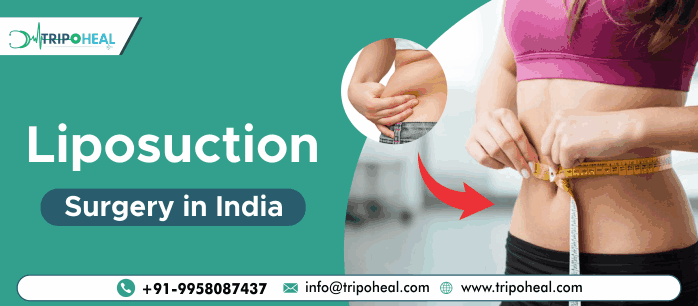 Liposuction Surgery in India