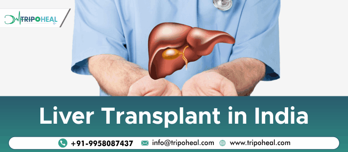 Liver Transplant in India