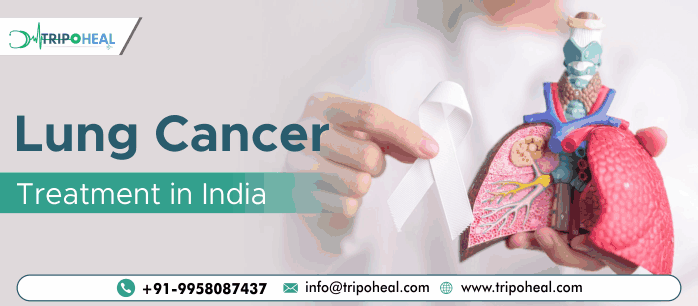 Lung Cancer Treatment in India: Comprehensive and Affordable Care