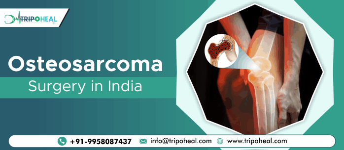 Osteosarcoma Surgery in India: Expert Care at Affordable Costs