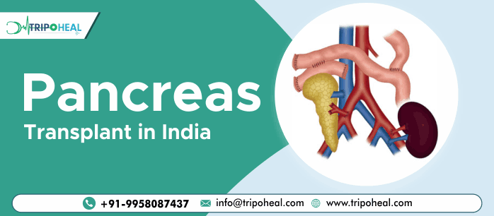 Pancreas Transplant Surgery in India