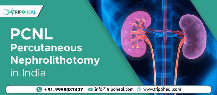 PCNL Percutaneous Nephrolithotomy in India