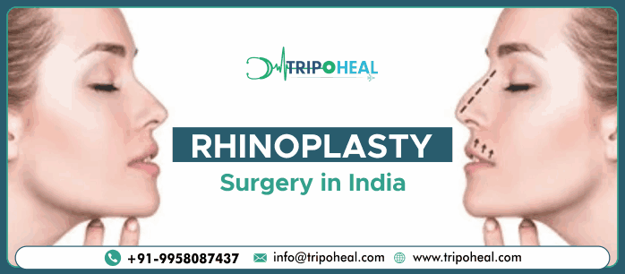 Rhinoplasty Surgery in India