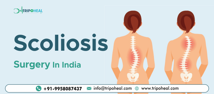 Scoliosis Spine Surgery in India