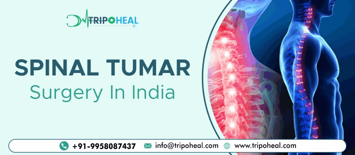 Spinal Tumors Surgery in India