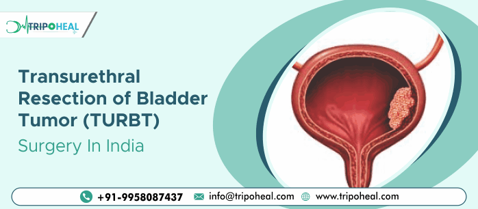 Transurethral Resection of Bladder (TURB) Tumor Surgery in India